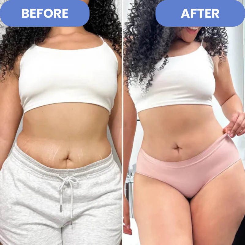 Cellu Fade - Anti-Cellulite Remover