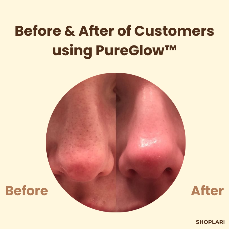 Last Day 1+1 FREE!🔥 PureGlow™ Black Tea Mask