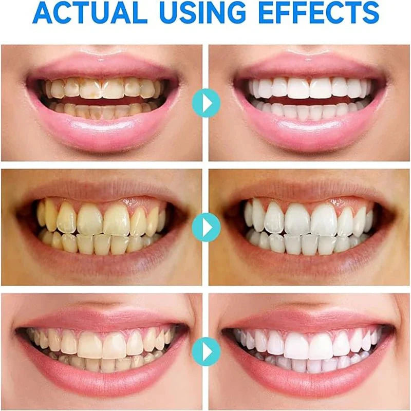 PureTeeth™ Niacinamide Whitening Toothpaste