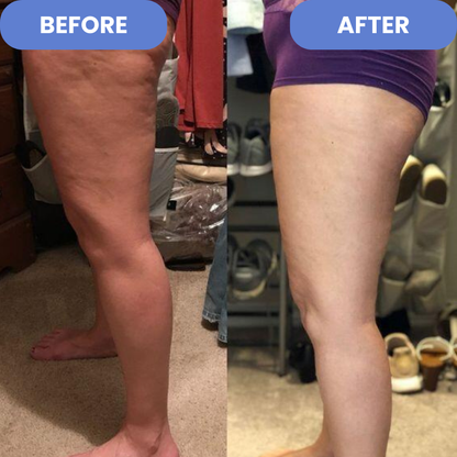 Cellu Fade - Anti-Cellulite Remover