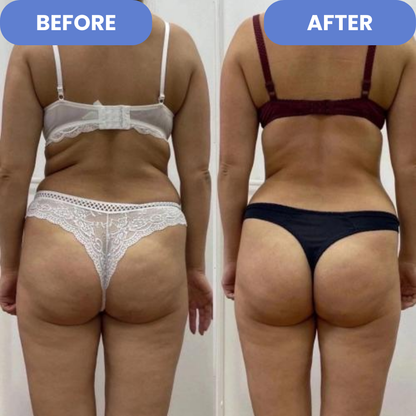 Cellu Fade - Anti-Cellulite Remover