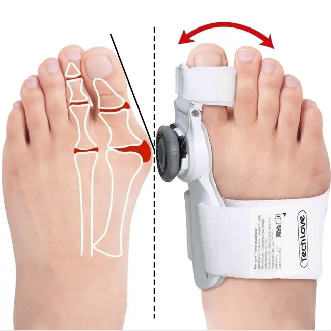 Hallux Valgus Corrector, Bunion Corrector Brace