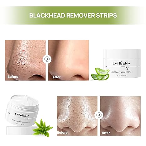 LANBENA™ Blackhead Remover Exfoliating Mask with 60 Strips