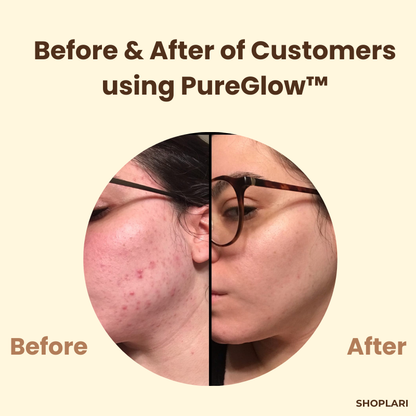 Last Day 1+1 FREE!🔥 PureGlow™ Black Tea Mask