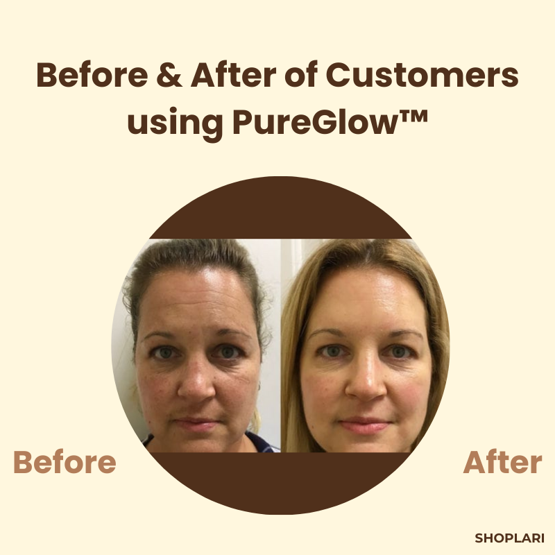 Last Day 1+1 FREE!🔥 PureGlow™ Black Tea Mask