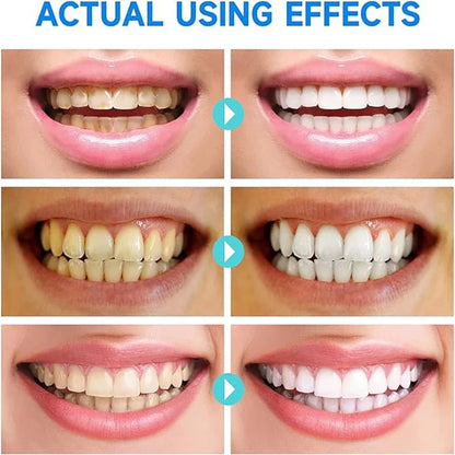 PureTeeth™ Niacinamide Whitening Toothpaste